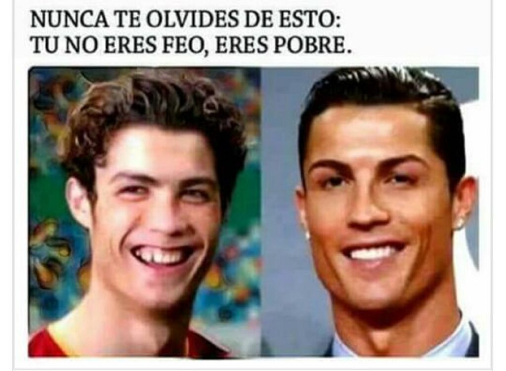 Meme del antes y después de Cristiano Ronaldo: no eres feo, eres pobre